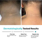 Nigriclear™ Cream for Pigmentation & Acanthosis Nigricans (50gm)