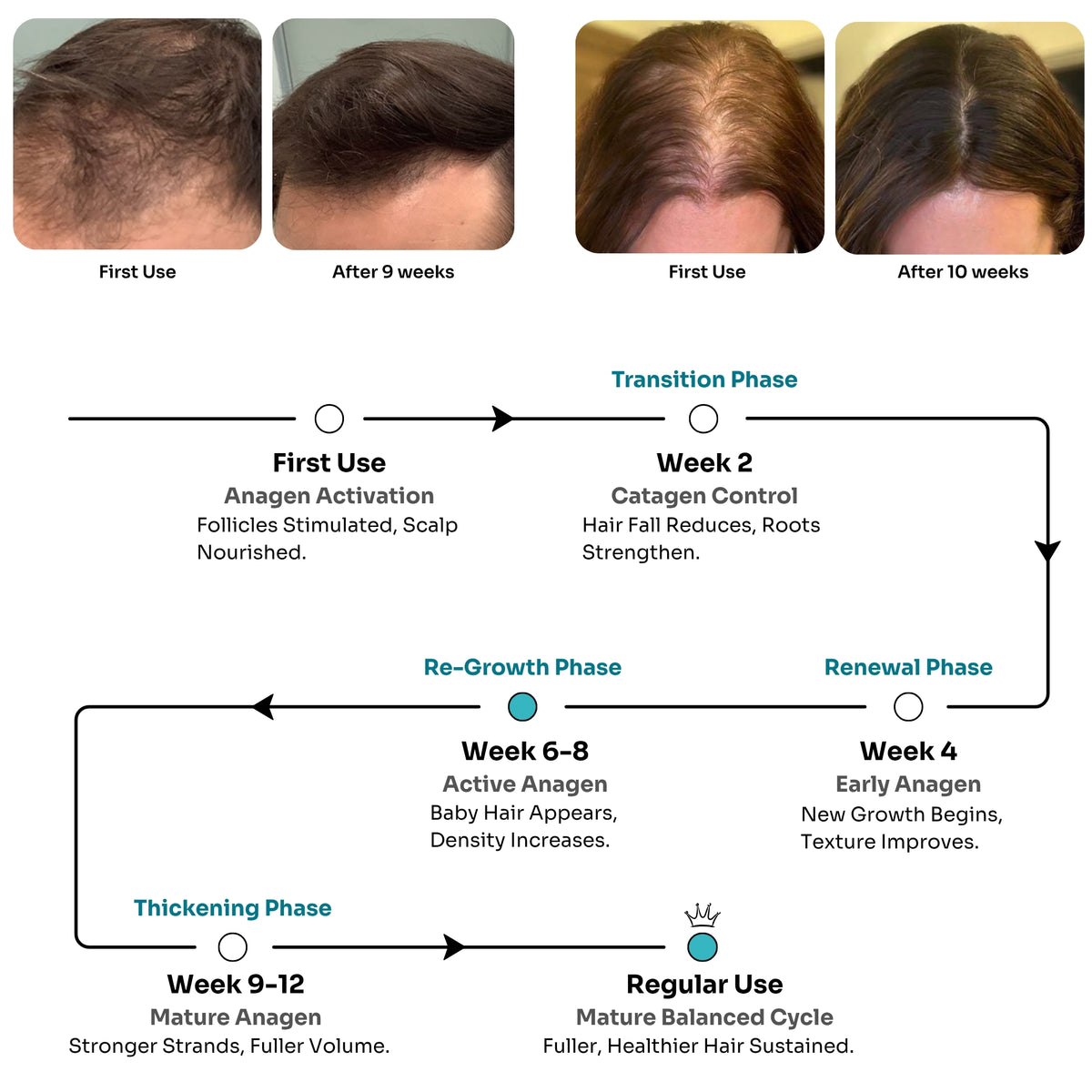 Advanced Hair Growth Serum, Unisex (30ml)