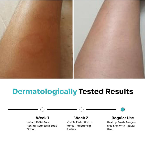 Anti Fungal Body Wash (300ml)