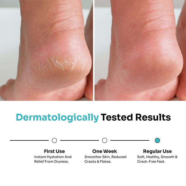 Foot Cream Roll On (50ml)