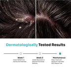 Kitcoz Daily Anti Dandruff & Anti Itch Shampoo (Non-Drying) with Ceramide Complex & Salicylic Acid (