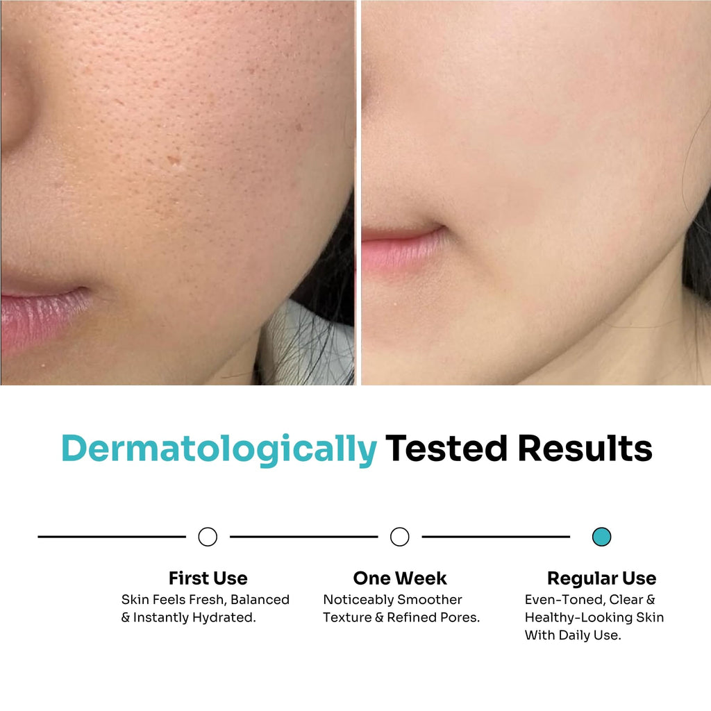 Kitcoz 5% Niacinamide, 8% Glycolic Acid & Rice Water Face Toner | Pore Tightening, Gentle Exfoliatin