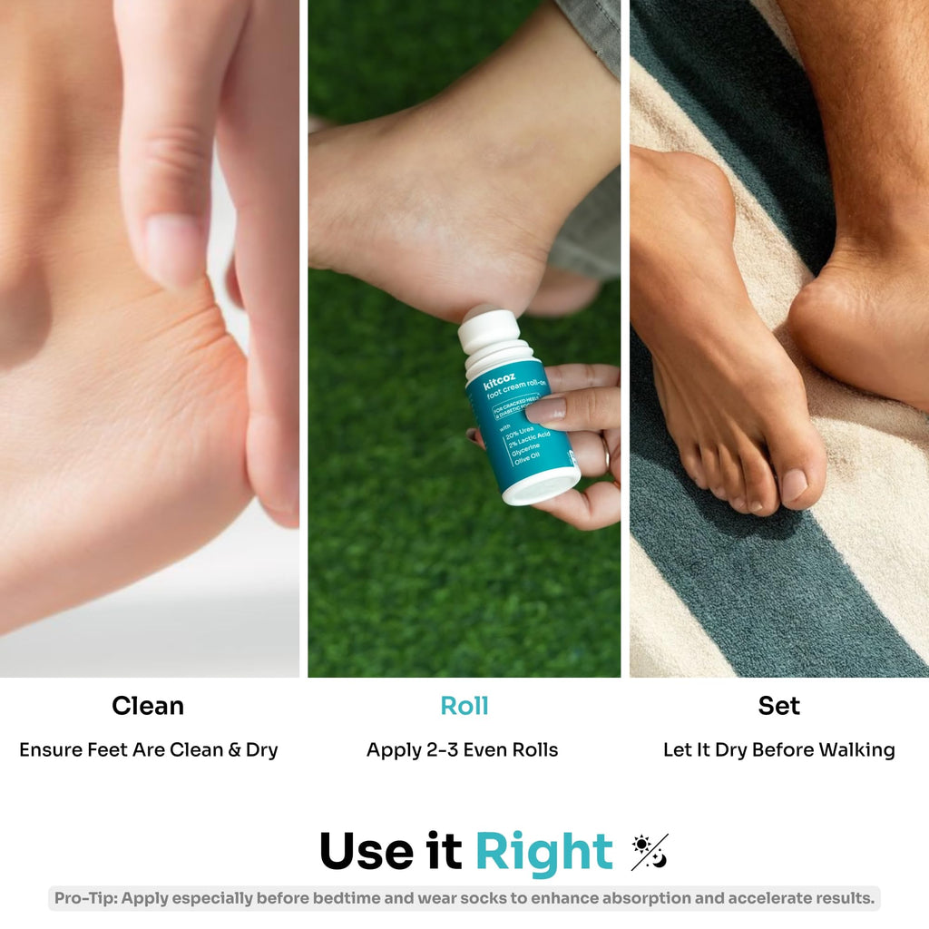 Kitcoz Foot Cream Roll On with 20% Urea, 2% Lactic Acid, Glycerine & Olive Oil for Dry Feet, Cracked